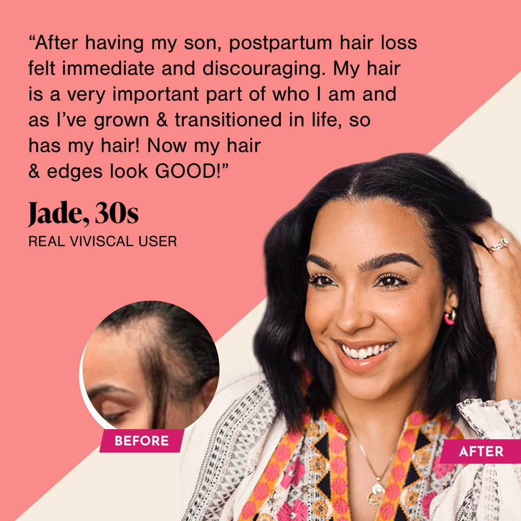 Viviscal Hair Growth Supplements For Women For Thicker, Fuller Hair, Nourishes Thinning & Loss