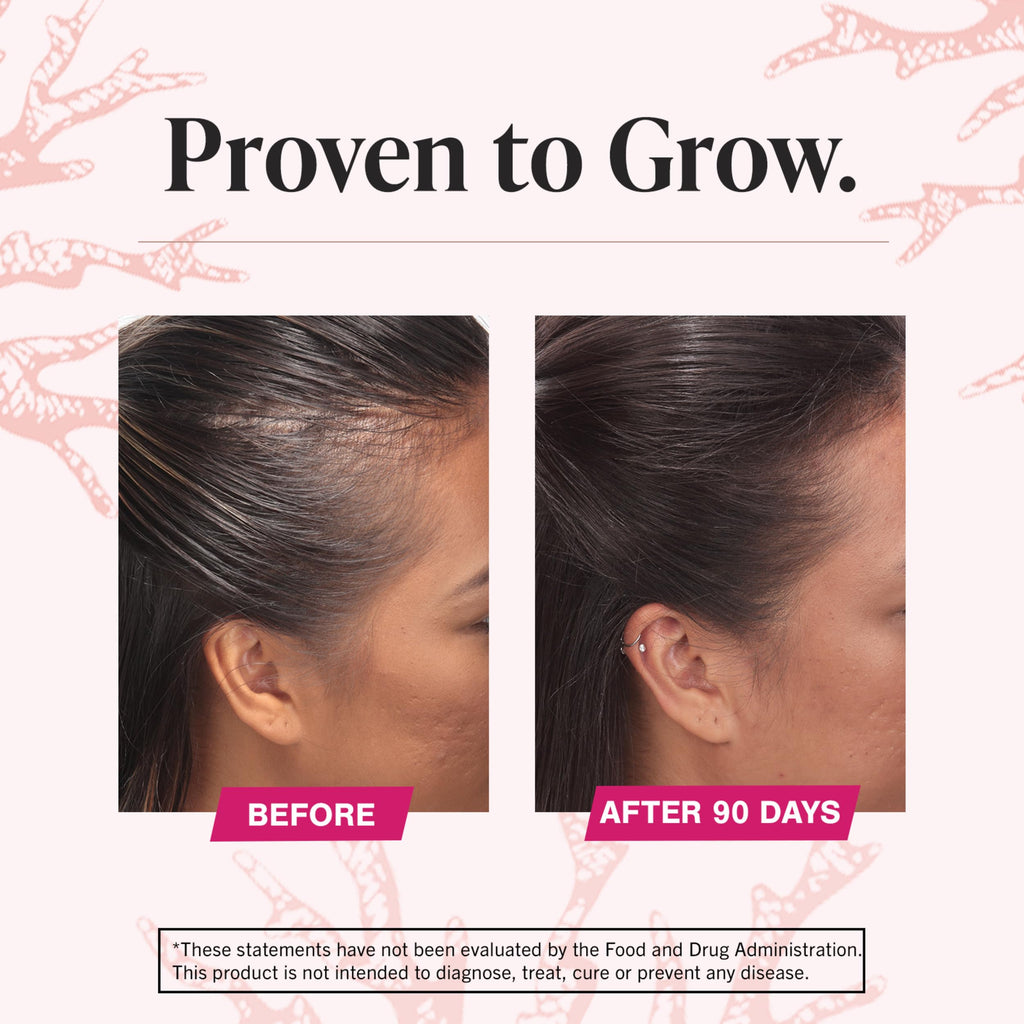 Viviscal Hair Growth Supplements For Women For Thicker, Fuller Hair, Nourishes Thinning & Loss