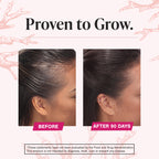 Viviscal Hair Growth Supplements For Women For Thicker, Fuller Hair, Nourishes Thinning & Loss