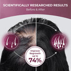 PUREHEALTH RESEARCH ReGrow – Hair Growth Vitamins for Scalp Health & Thickness Support (60 Capsules)